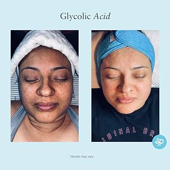 glycolic acid Benefits.jpg
